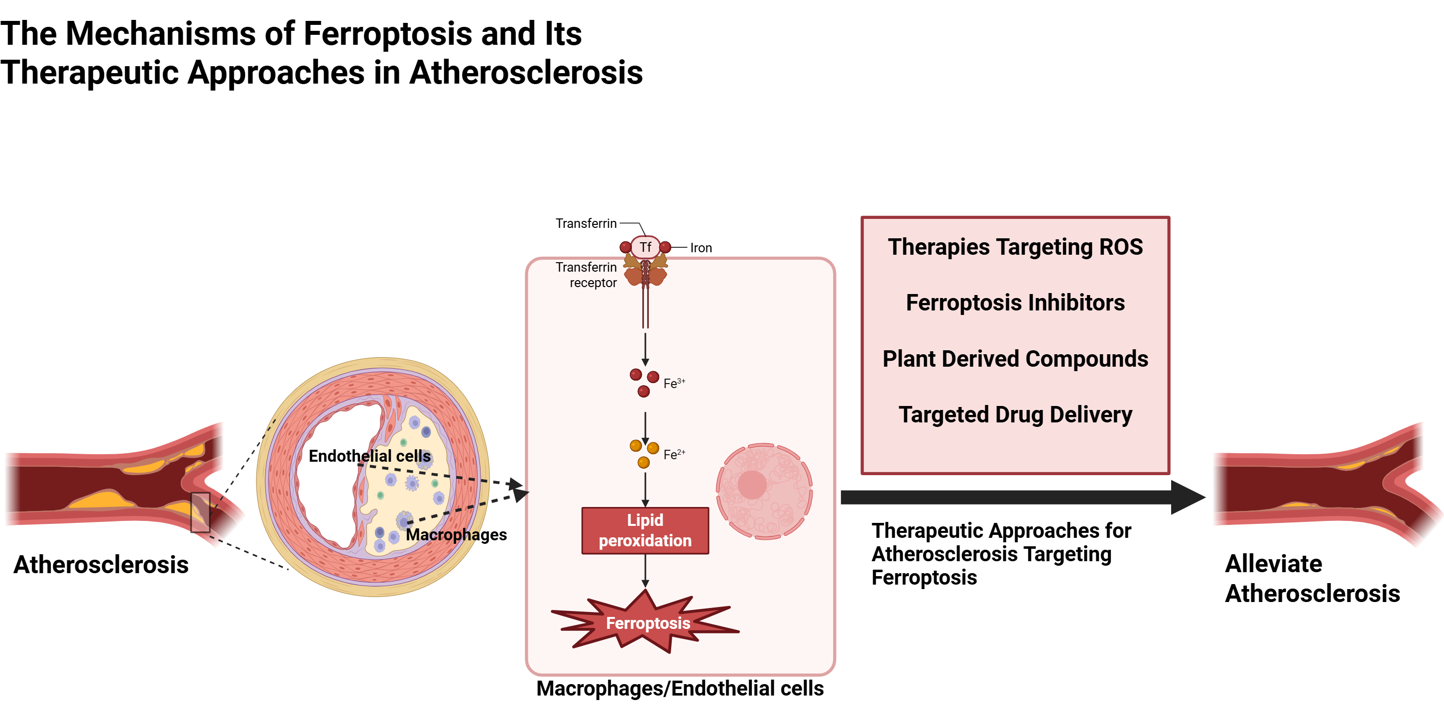 Ferroptosis of Macrophages and Endothelial Cells in