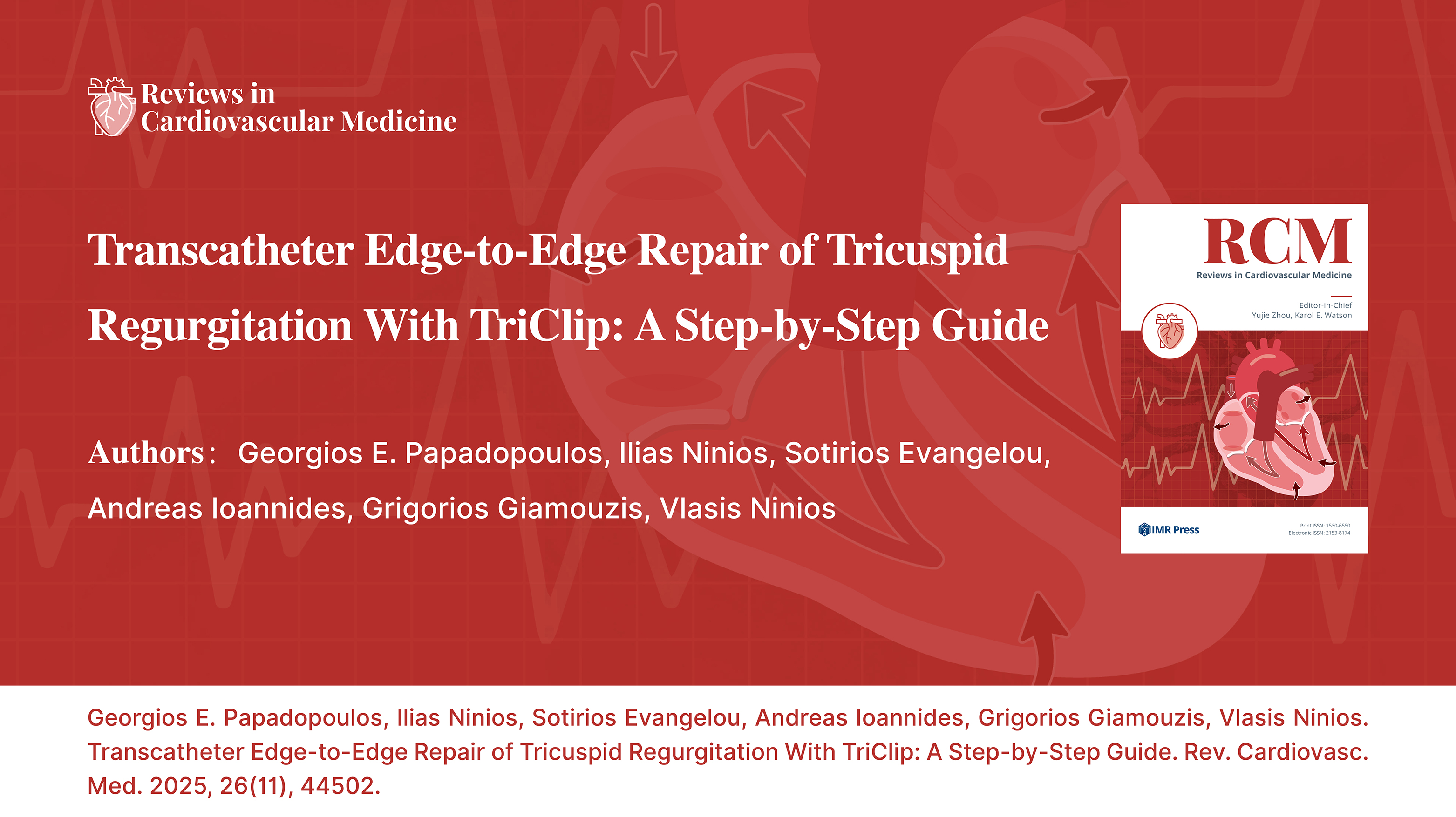Video thumbnail for  Transcatheter Edge-to-Edge Repair of Tricuspid Regurgitation With TriClip: A Step-by-Step Guide — Video interpretation by Vlasis Ninios
