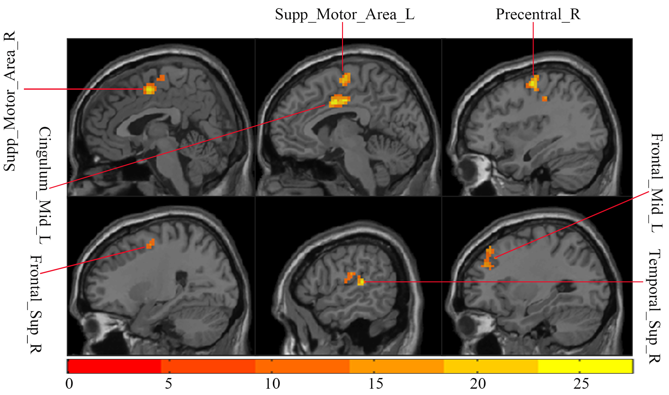 Neural Correlates of Diagnostic-Relevant Emotional Processing in ...
