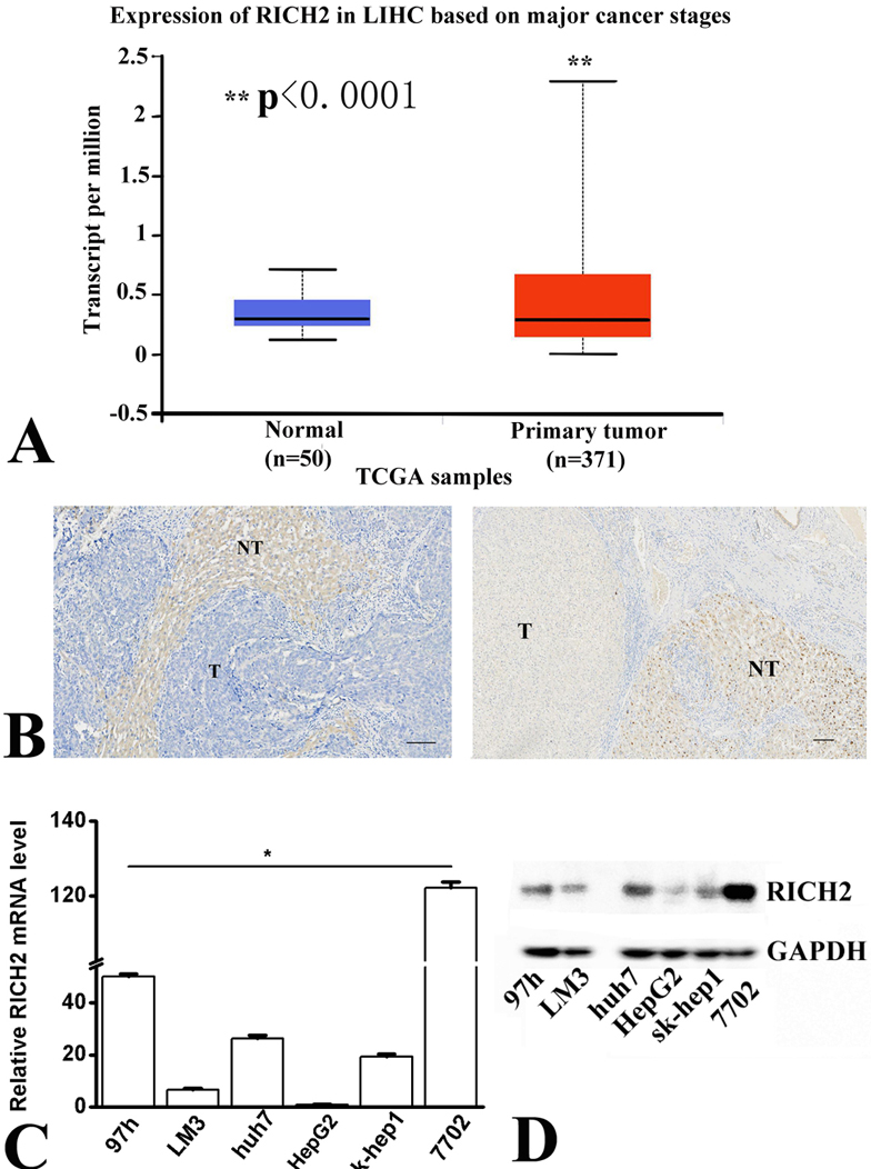 RICH2, a potential tumor suppressor in hepatocellular carcinoma