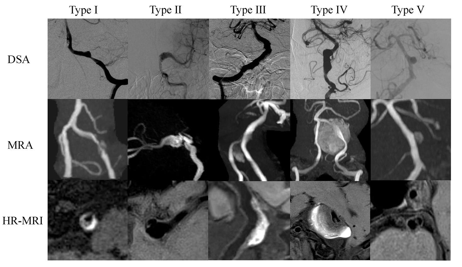Assessment of Morphological Features and Imaging Characteristics of ...