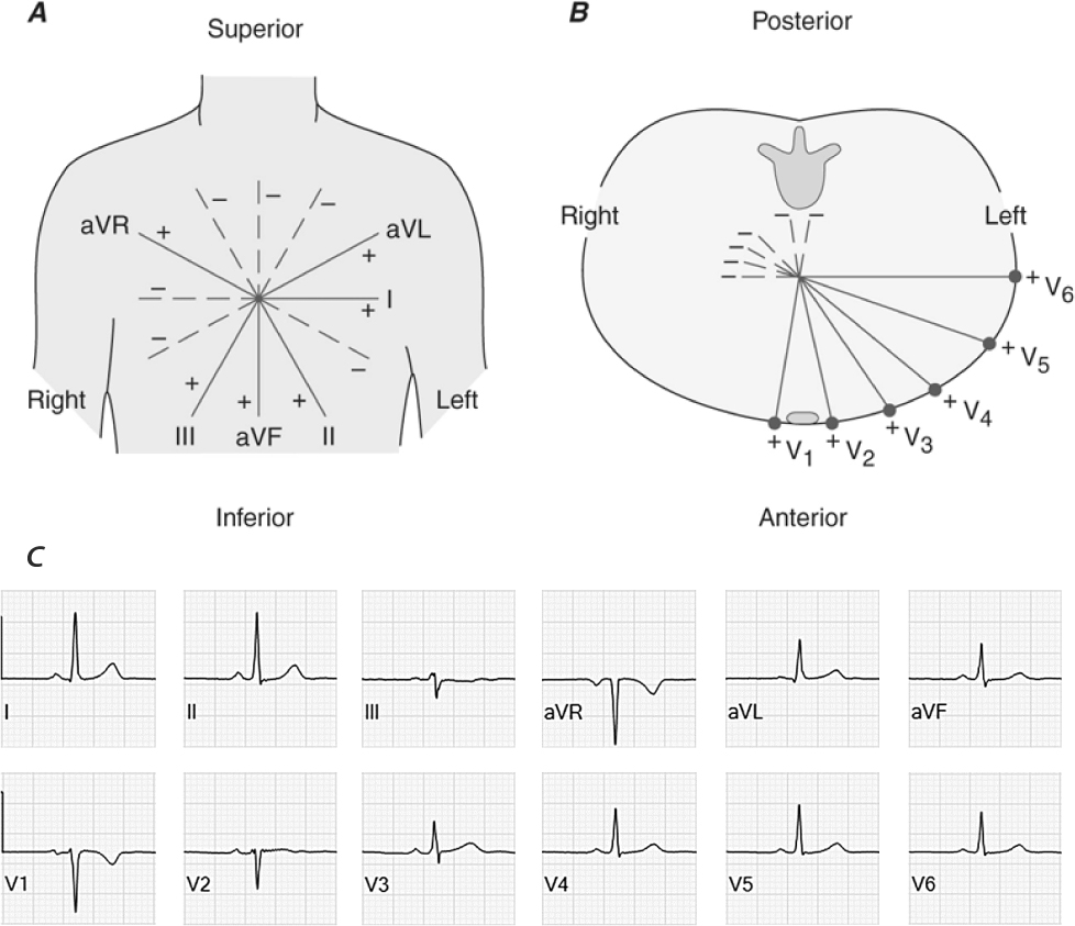Ventricular Depolarization Abnormalities and Their Role in Cardiac Risk ...