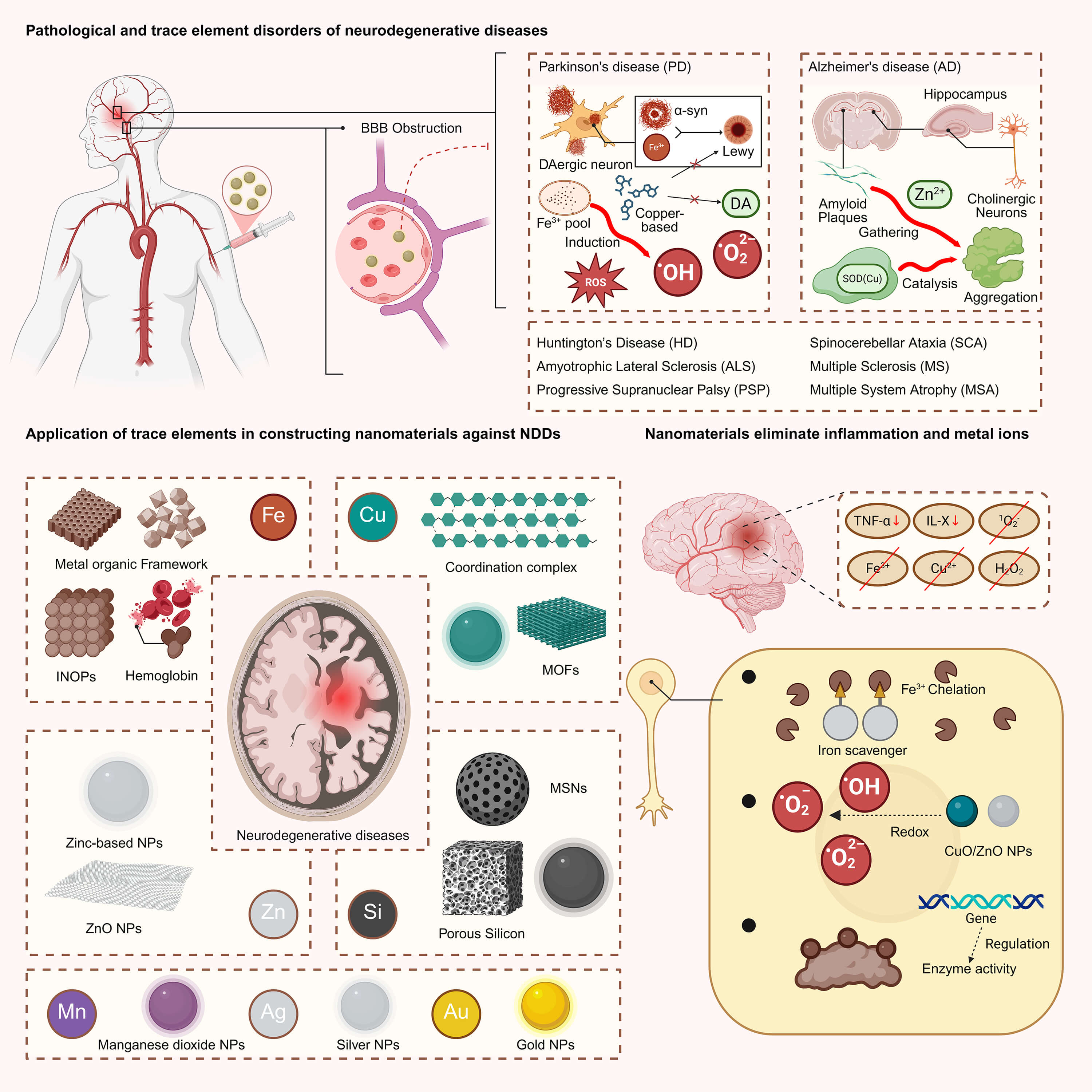 Trace Element Nanoparticles for Neurodegenerative Disease Therapy