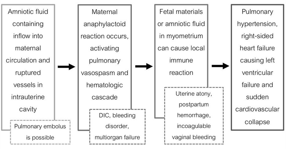Amniotic fluid embolism: the pathophysiology, diagnostic clue, and ...