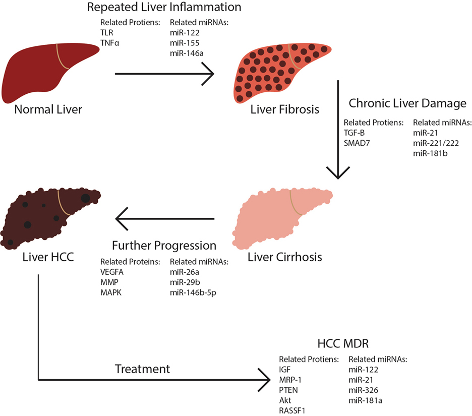 Role of microRNAs in the development of hepatocellular carcinoma and ...