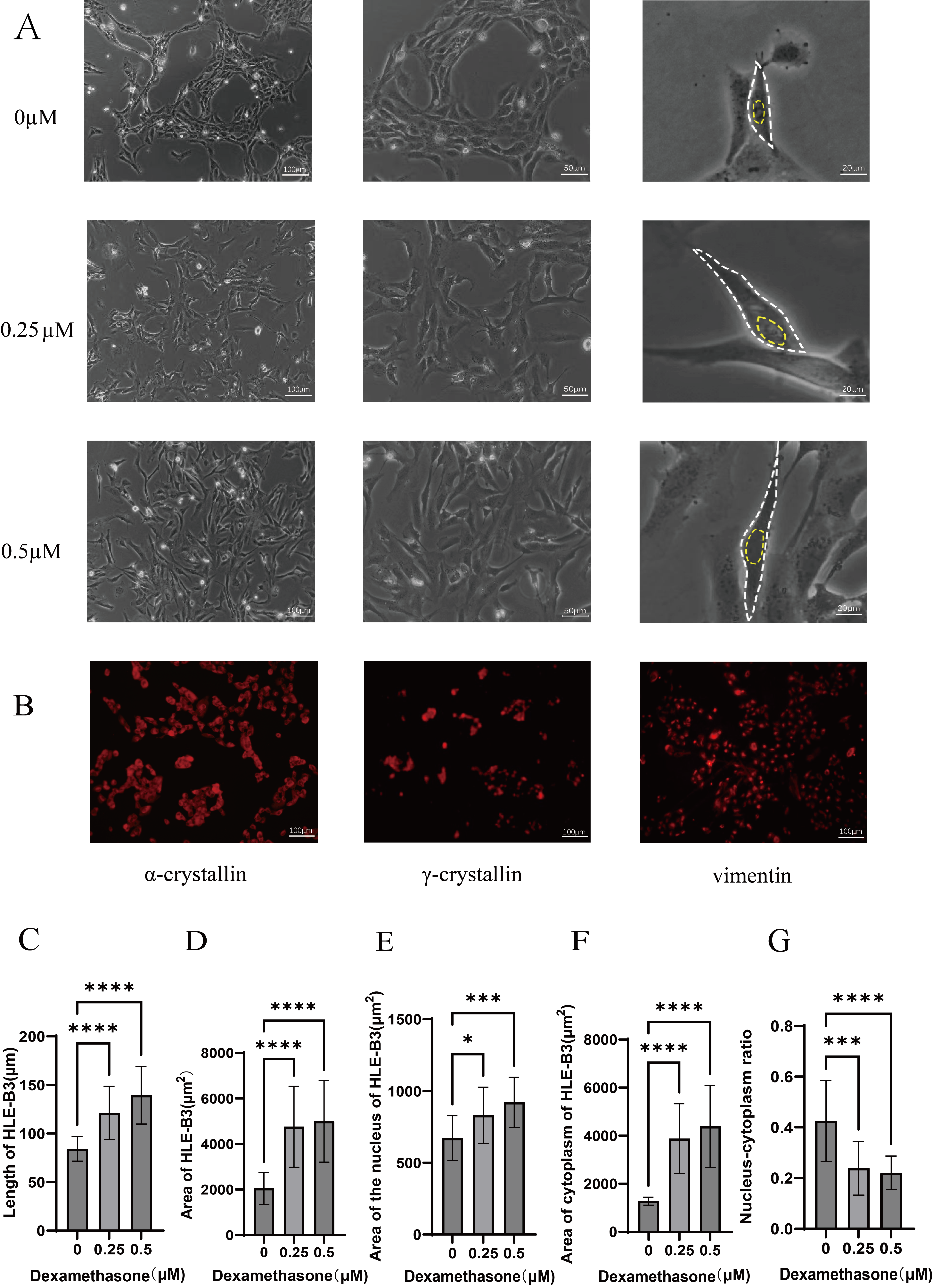The Effects of Dexamethasone on Human Lens Epithelial Cells and the ...
