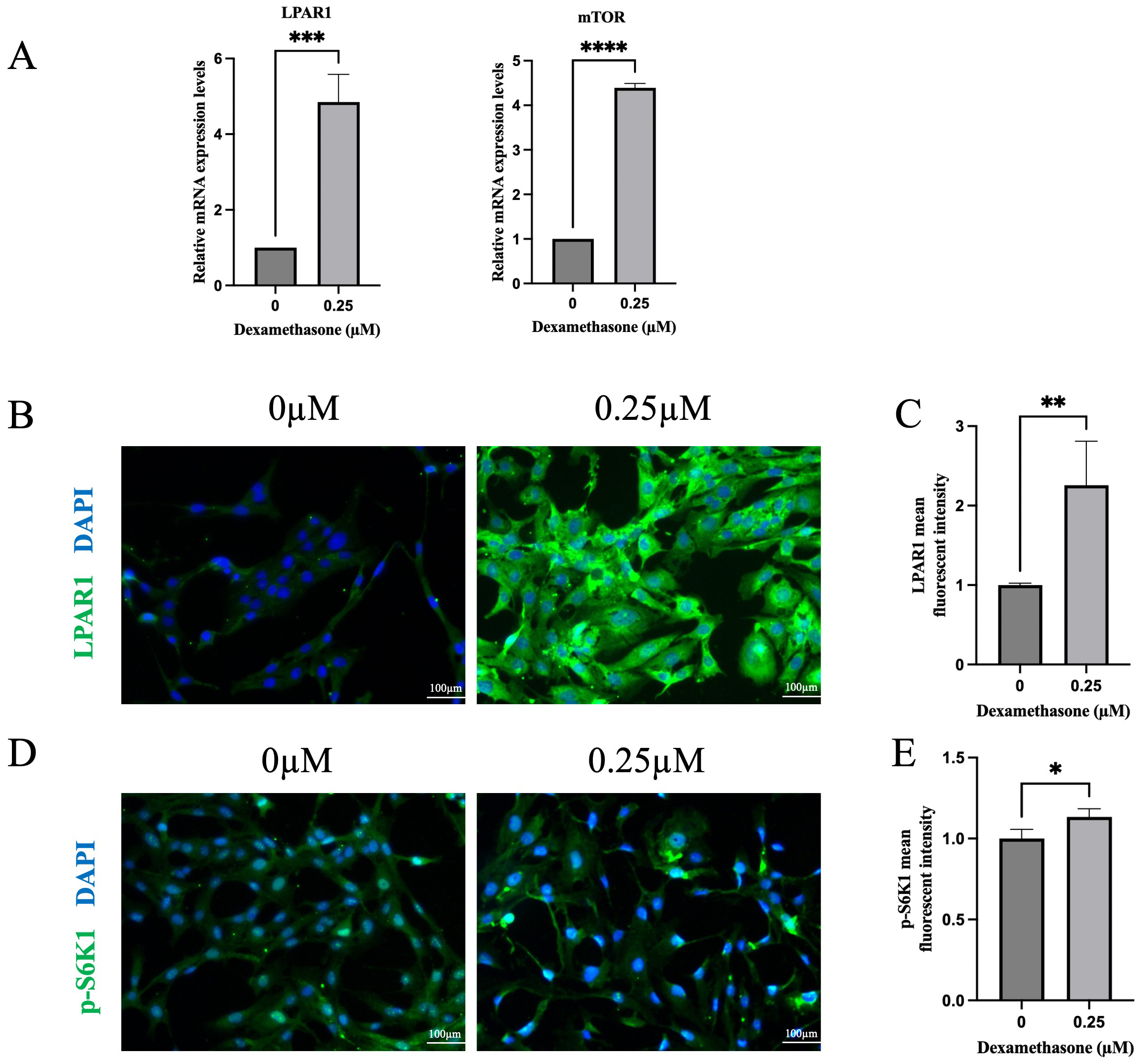 The Effects of Dexamethasone on Human Lens Epithelial Cells and the ...
